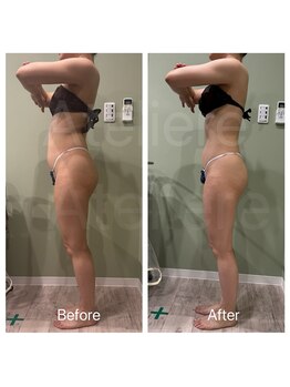 アトリエール(Ateliere)/中性脂肪が気になる方☆必見☆