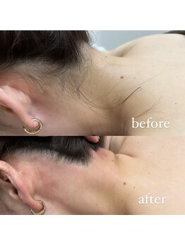 フェリーチェネイル(felice Nail)/ワックス脱毛