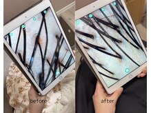 ビカム(become)/頭皮チェックは大切です！