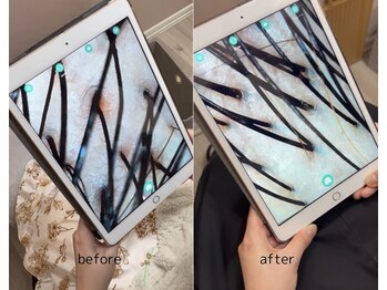 ビカム(become)/頭皮チェックは大切です！