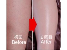 ネムレル森(Nemureru森)の雰囲気（【水巻/中間/折尾】ムダ毛の悩みを減らし美肌へ！！）