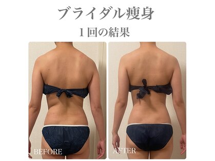 イリゼ(IRISER)の写真