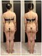 トータルボディセラピーハート(Heart)の写真/【バストアップ×痩身】メリハリBODYに痩せるが叶う★お腹ポッコリ/背中肉/脇肉/ヒップUP/くびれを全部解決