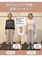 スペックフィジカルコンディショニング(SPECフィジカルコンディショニング)/60代女性/姿勢ビフォーアフター