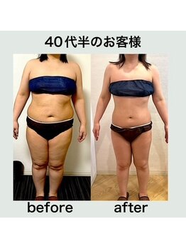 エステサロンクオーツ/40代半のお客様の変化！