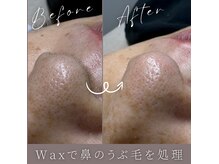 ランプシー(Lampsi)の雰囲気（ツルツル美肌になるフェイスWaxでうぶ毛のない肌に☆）