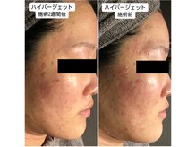 ビオール(be all)の雰囲気（肌荒れの原因を根本から解決！小顔効果も！）
