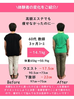 あおぞら鍼灸整骨院/ダイエットコース お客様の声23