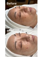 フジモトサロン 那覇おもろまち店(fujimotoサロン)/韓国肌管理＋天使の水光肌