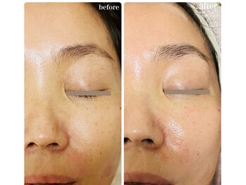 ムク(MUKU 無垢)/セラピールでくすみケア