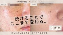ユヌランコント 岐阜店(Une rencontre)