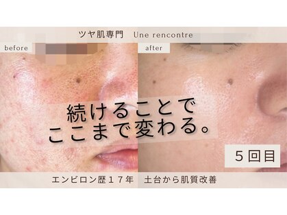 ユヌランコント 岐阜店(Une rencontre)の写真