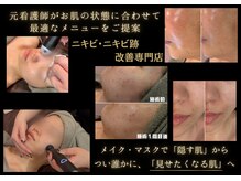 バルディーナ(BALDINA)