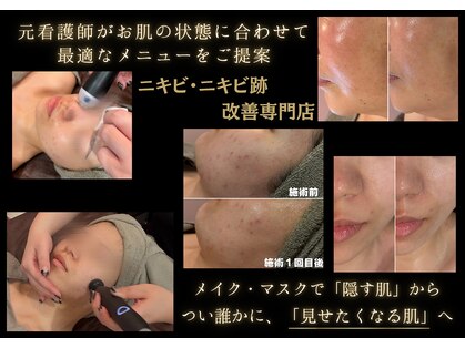 バルディーナ(BALDINA)の写真