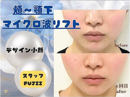 クロエビューティー 麻布十番店(クロエbeauty)の写真