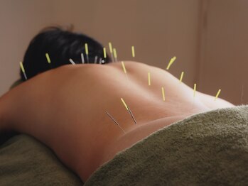 堀川鍼灸 接骨院/鍼灸施術