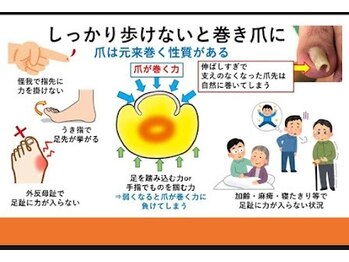 とくしま整体院 藍住院/巻き爪でお困りの方必見!