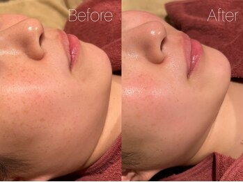 ビヨンド リンク(BEYOND L'INK)/フェイシャルマッサージ