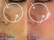 いやしの家さくら/シミケアのビフォーアフター