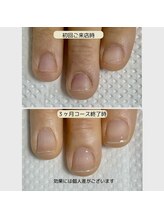 ルームイチマルイチネイルズ(Room101Nails.)/自爪育成・最強のネイルケア鳥取