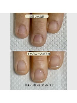 ルームイチマルイチネイルズ(Room101Nails.)/自爪育成・最強のネイルケア鳥取