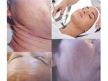 [予防美容]お悩みが重い方