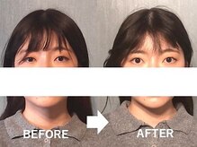 アトラス/初回のお客様のBefore＆after