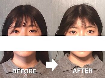 アトラス/初回のお客様のBefore＆after