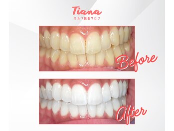 ティアナ 神栖店(Tiana)/before/after