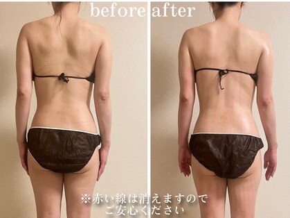 アビヤンガの写真