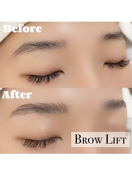 ブル(b.u.l.l.)/眉癖改善☆ブロウリフト