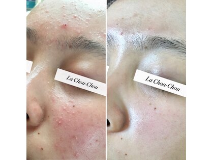 ラシュシュ(La Chou Chou)の写真