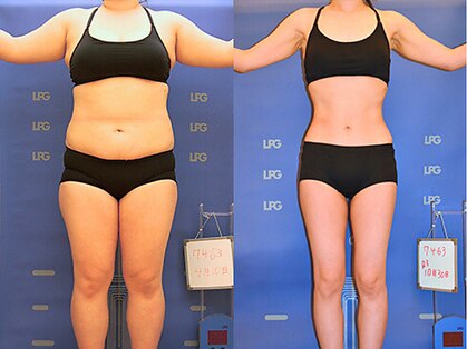 ピュアノア 三木店の写真