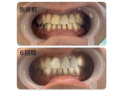 ホワイトニング専門店 スマイルホワイトの写真