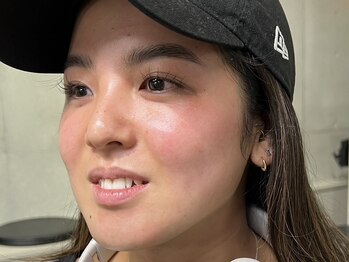 ラシサ(LASHISA)/フェイスワックス(全顔)