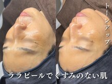 ダリア(Dahlia)/くすみ感改善！ララピール