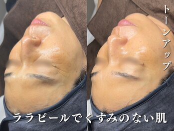 ダリア(Dahlia)/くすみ感改善!ララピール