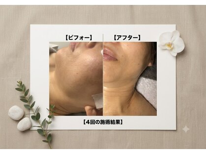 リボーン(RE BORN)の写真