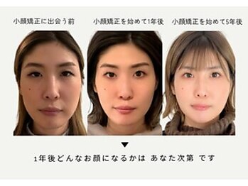 キュープ 鹿児島伊集院店(Qpu)の写真/リピート率9割★《たった20分の小顔矯正》超人気芸能人ご用達サロン！気になる実力は口コミをCHECK！