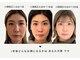 キュープ 鹿児島伊集院店(Qpu)の写真/リピート率9割★《たった20分の小顔矯正》超人気芸能人ご用達サロン！気になる実力は口コミをCHECK！