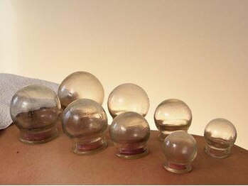 八柱整体院 成瀬店/人気の吸い玉メニュー