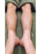 ココ(KoKo)/日焼けをしていても大丈夫♪