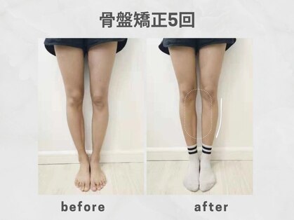 ビトリア 小顔 骨盤美容矯正サロン(BITORIA)の写真