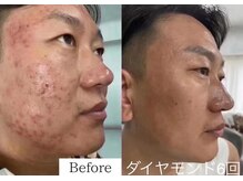 ミューズファクトリー(Muse factory)/肌悩みを根本改善！