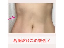 レポリア(Reporia)の雰囲気（90分1回でくびれクッキリ。次世代リンパマッサージの成果◎）