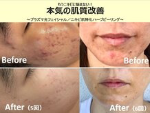 くつろぎ処癒家