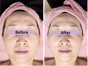 マリア(MALIA)/イベント前小顔仕込み