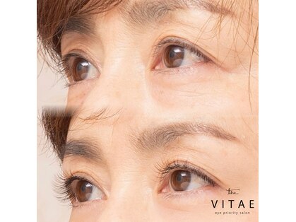 ザ ヴィタエ(The VITAE)の写真