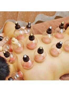 今日はいい日だセラピールーム (Room)/吸い玉