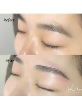 クレー(Klee)/アイブロウリフト